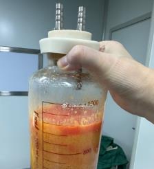 常宁水动力吸脂手术要做多久？